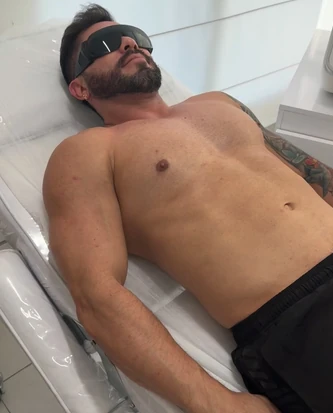 Paciente deitado na maca com óculos de proteção durante procedimento com laser